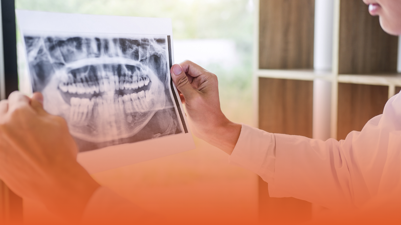 Dentist examining a scan: used as a blog banner for Densura's GDC CPD Requirements​ blog.